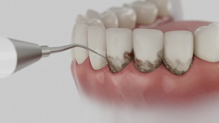 Reliable Wisdom Tooth Removal contractor in Dallas County County, AL by Dentist Open Now
